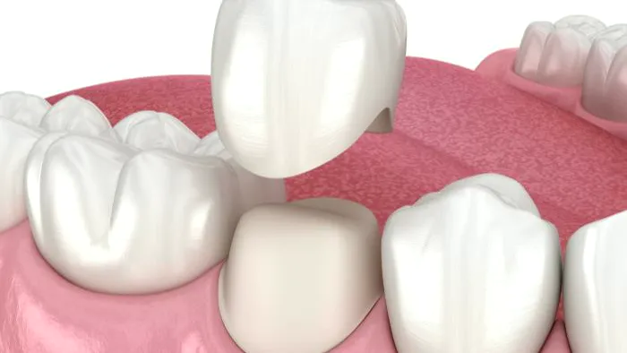 dentist in pasadena, Pasadena